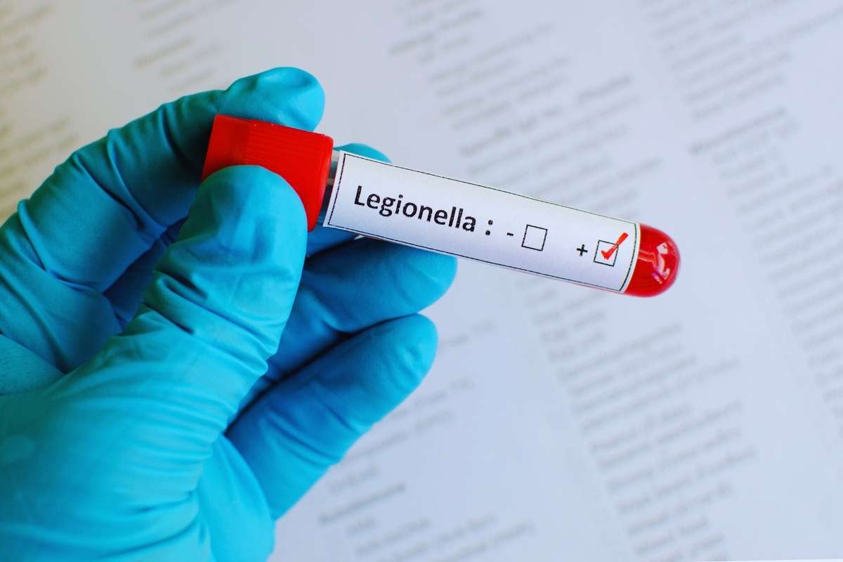 Legionella batterio